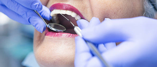 Best Chipped Tooth Repair Near Me  in Opelousas, LA