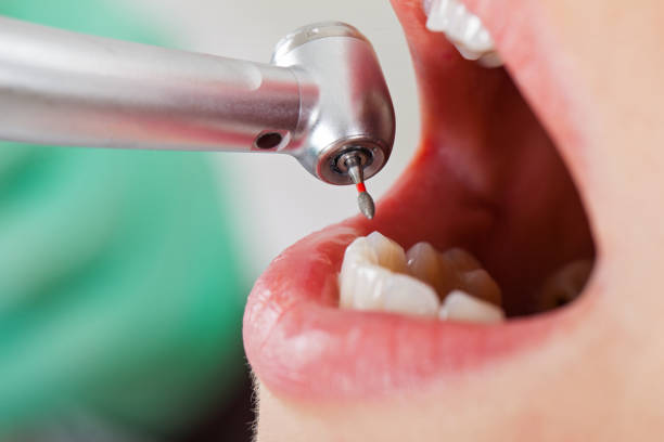 Best Urgent Tooth Repair  in Opelousas, LA